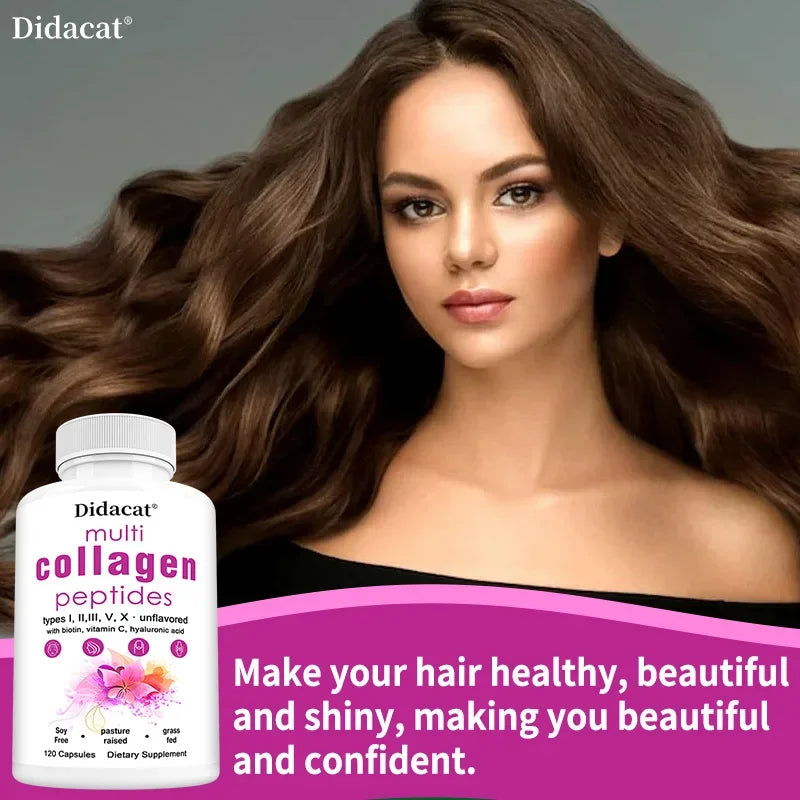 Multi-Collagen Peptides Supplement - Skin, Hair, Nails, Bone and Joint Health, Immunity, Free Radical Balance, Non-GMO