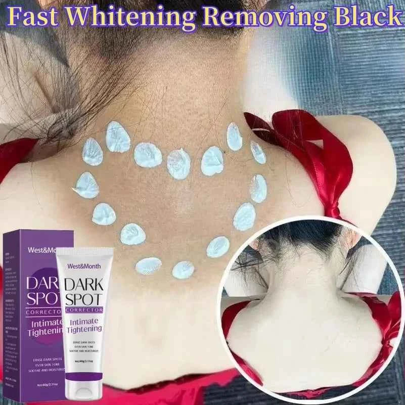 Nicotinamide Whitening Cream for Dark Skin Brightening Remove Melanin ...