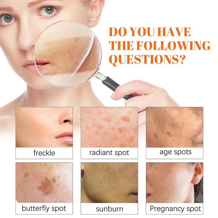 EELHOE Day Night Face Cream Papaya Day Night Even Skin Tone Corrector Removing Blemish Bleaching Nourishing Face Care Cream 1set