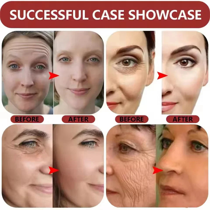 Bee Venom Anti-Aging Cream Rejuvenate face Skin Deep Moisturizing Fade Lines Fast Absorption Repair Instant Wrinkle Skincare