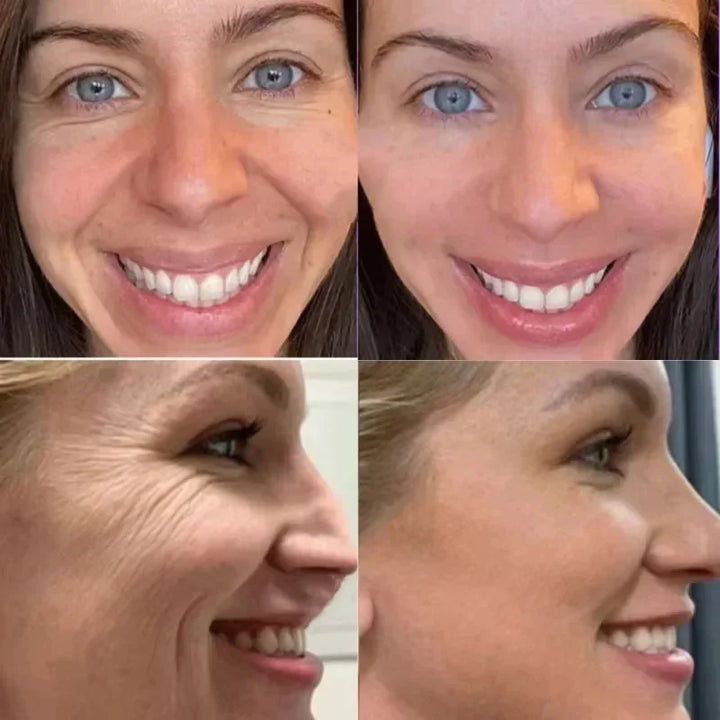 Bee Venom Anti-Aging Cream Rejuvenate face Skin Deep Moisturizing Fade Lines Fast Absorption Repair Instant Wrinkle Skincare