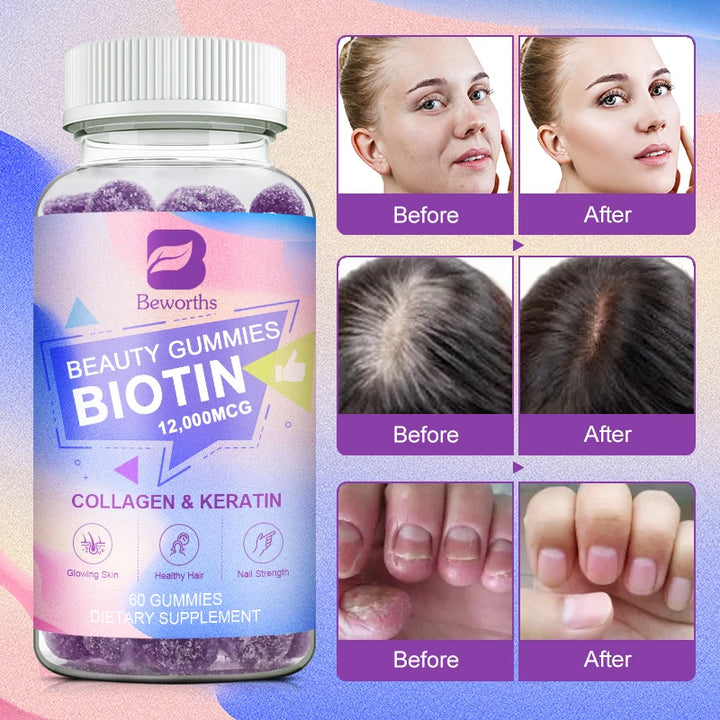 BEWORTHS Collagen Biotin Gummies Biotin for Hair Growth Strengthen Hair Roots & Nails Prevente Hair Loss Skin Care Beauty Health
