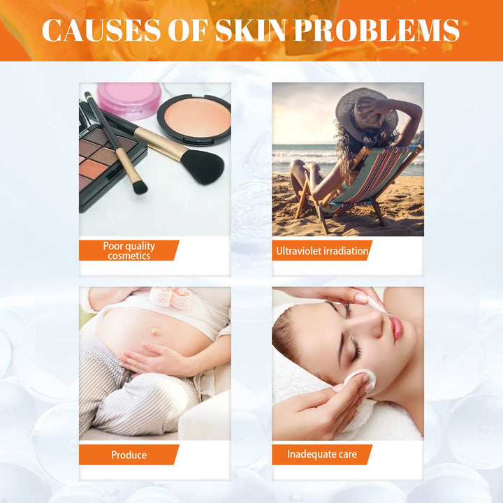 EELHOE Day Night Face Cream Papaya Day Night Even Skin Tone Corrector Removing Blemish Bleaching Nourishing Face Care Cream 1set