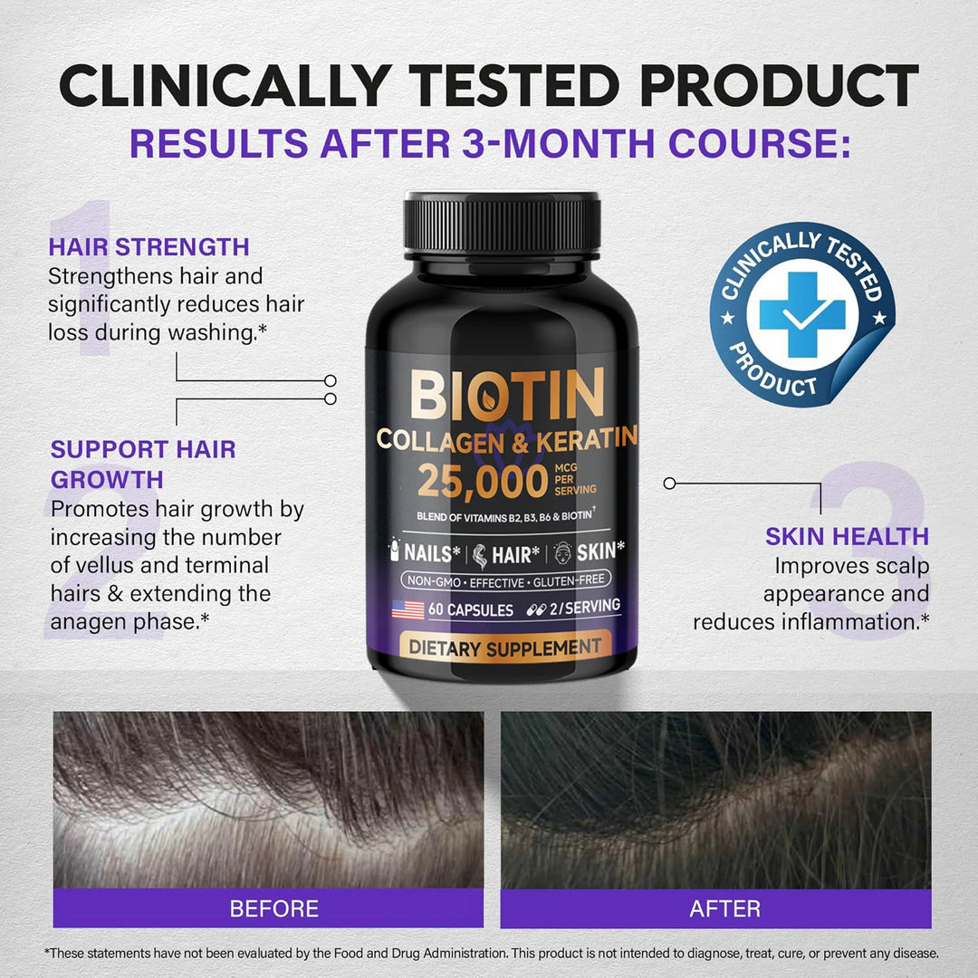 Biotin Collagen&Keratin 25000 mcg Vitamins B2, B3, B6 - Non-GMO Dietary Supplement for Hair Growth Support - USA Made - 60 caps